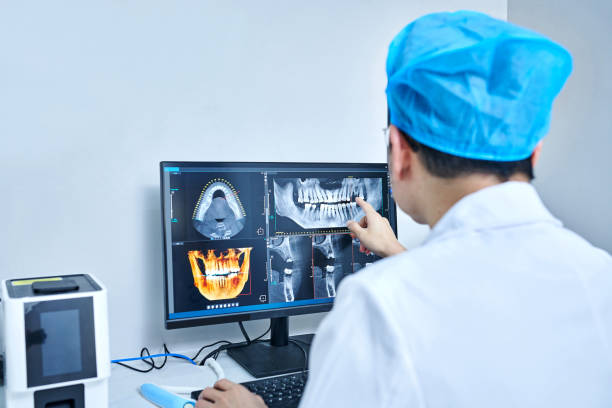 Best Emergency Root Canal Treatment in Man, IL