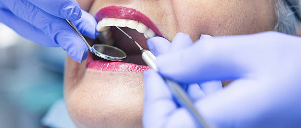 Best Emergency Dental Care for Abscessed Tooth in Man, IL