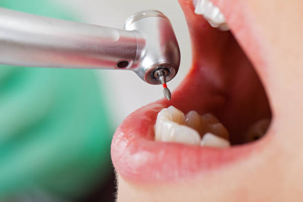 Best Emergency Dental Care for Abscessed Tooth in Man, IL